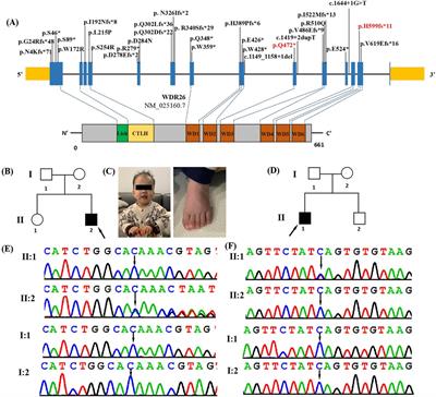 Novel loss-of-function variants in WDR26 cause Skraban-Deardorff syndrome in two Chinese patients